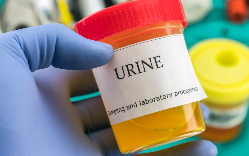 doctor with urine sample